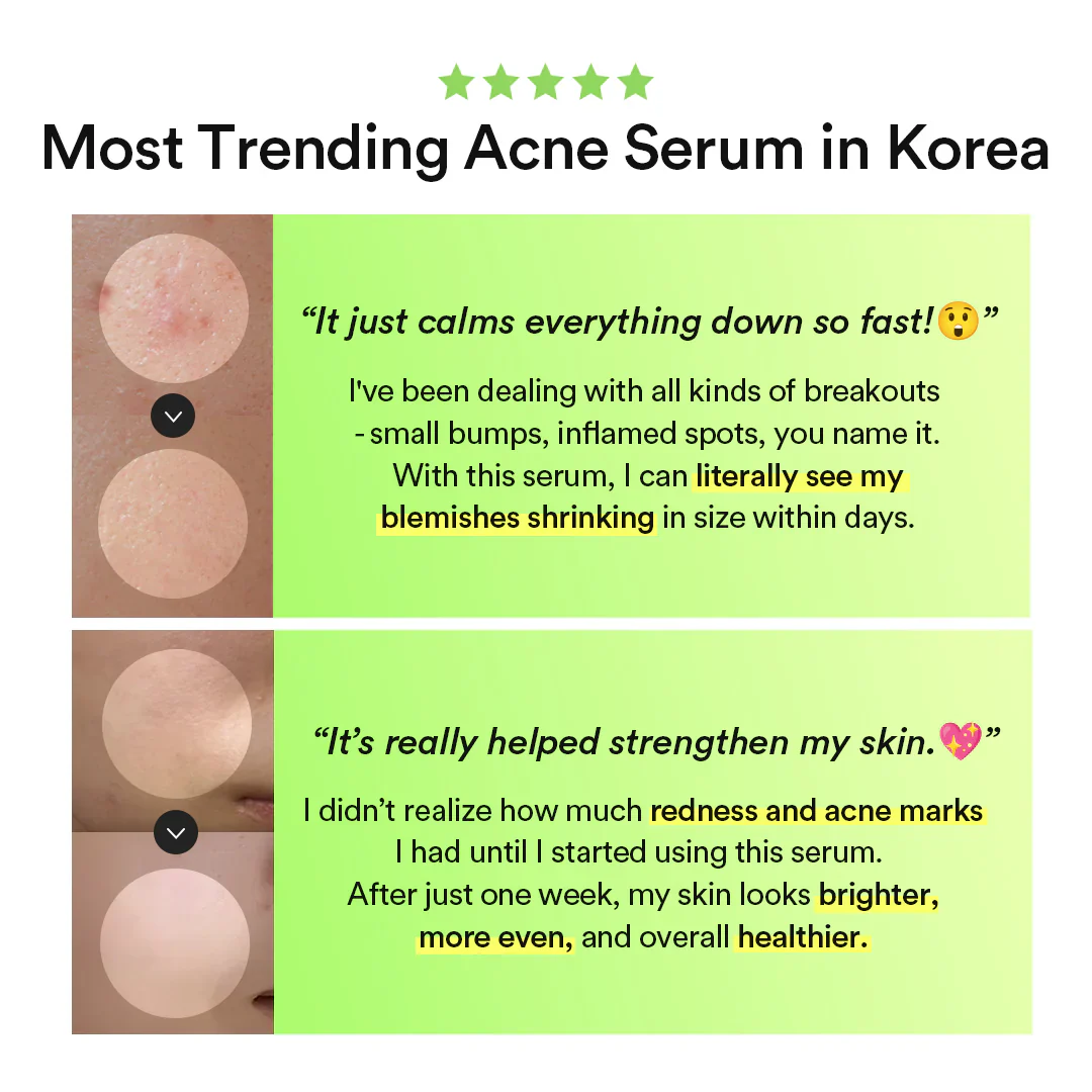 Abib Serum Heartleaf TECA capsule 50ml - Image 5