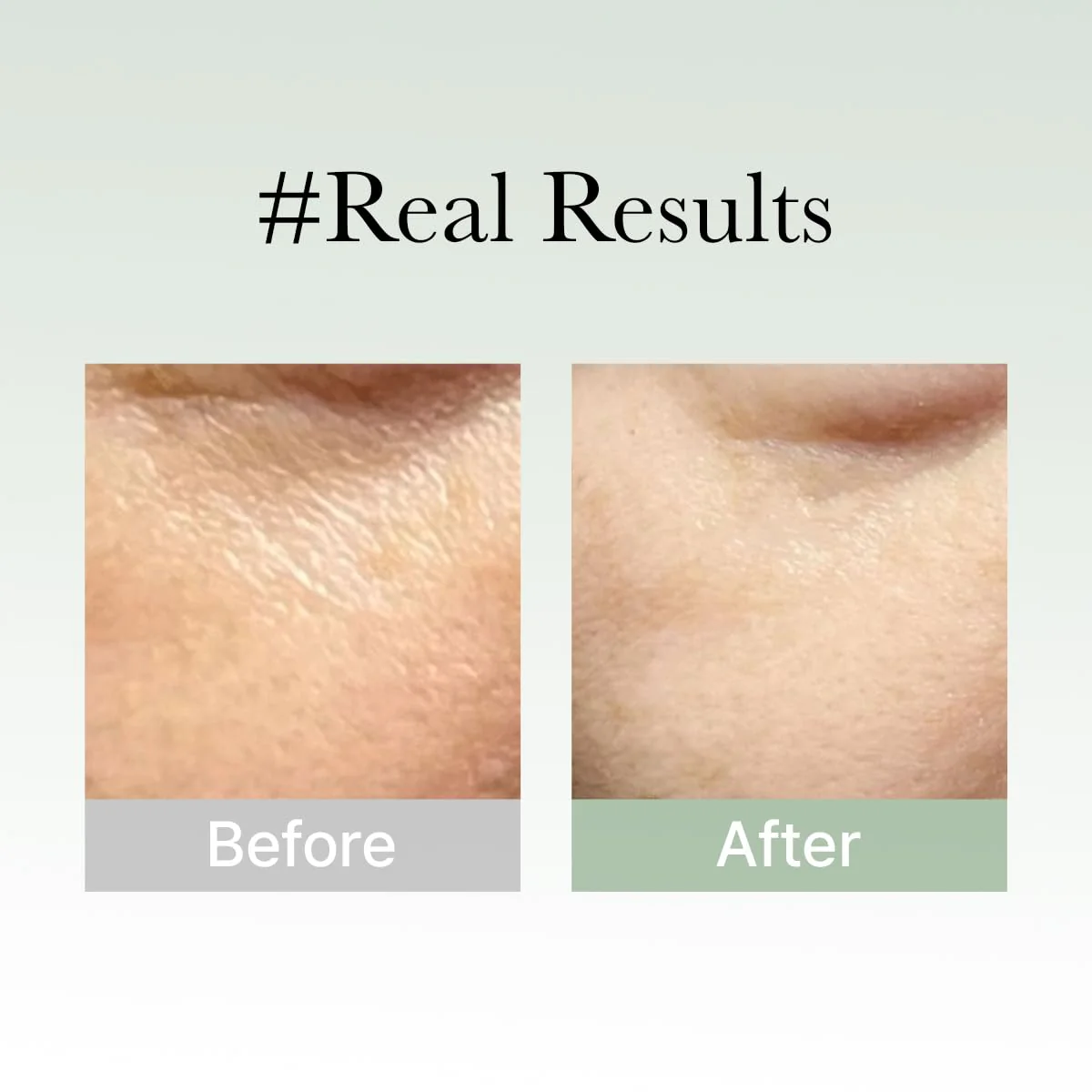 Arencia Holy Hyssop Serum 30 Suero de máscara facial - Image 7