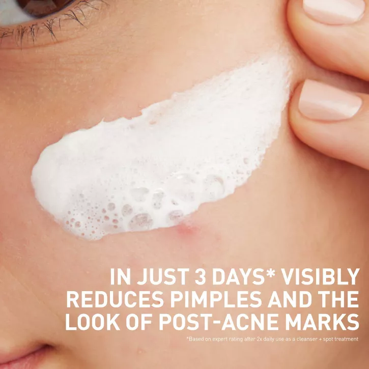 CeraVe 3in1 Acne Clay-to-Foam Facial Cleanser, Mask & Spot Treatment - Image 7