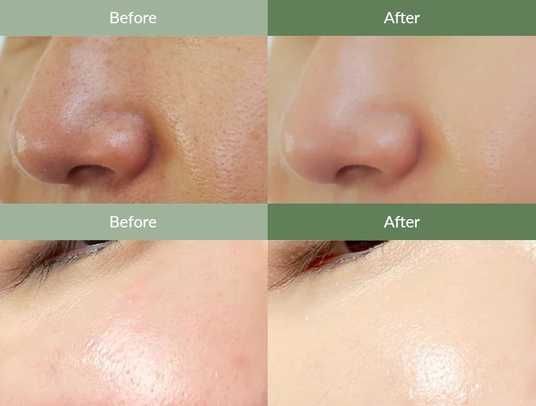 Dr.Althea Premium Quick Step Sebum Cleanser Limpiador de sebo - Image 4
