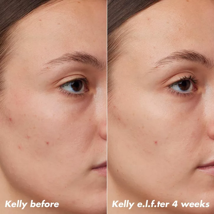 e.l.f. PLZ Clarify Facial Oil - 2% Salicylic Acid Acne Treatment + Aloe Extract 30ml - Image 10