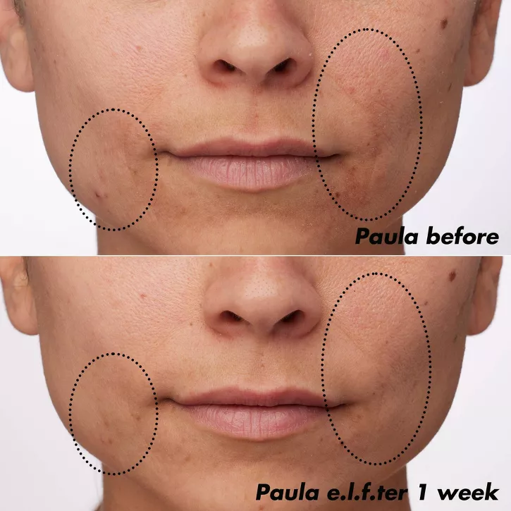 e.l.f. PLZ Clarify Facial Oil - 2% Salicylic Acid Acne Treatment + Aloe Extract 30ml - Image 11