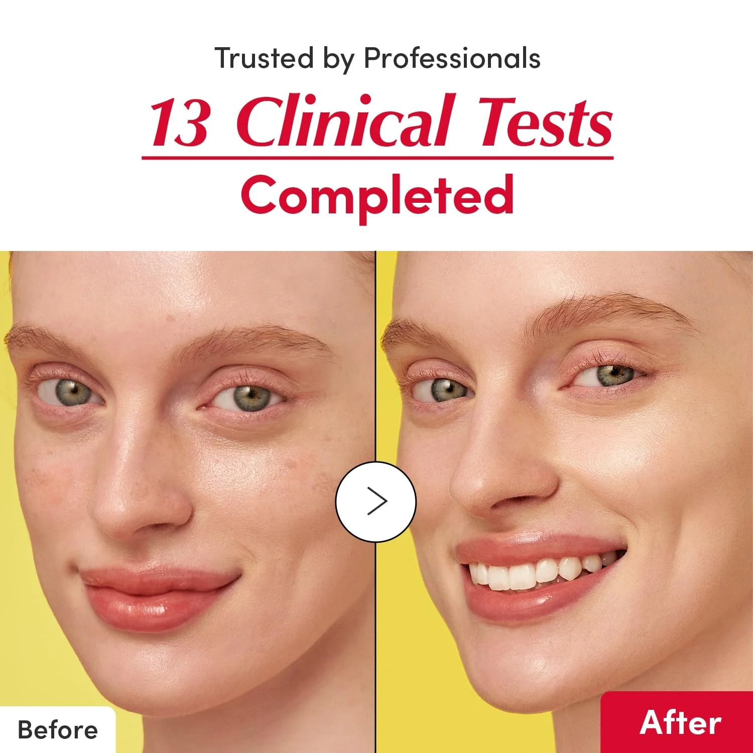 Eqqualberry Vitamin illuminating Serum con Vitamina C y niacinamida - Image 7