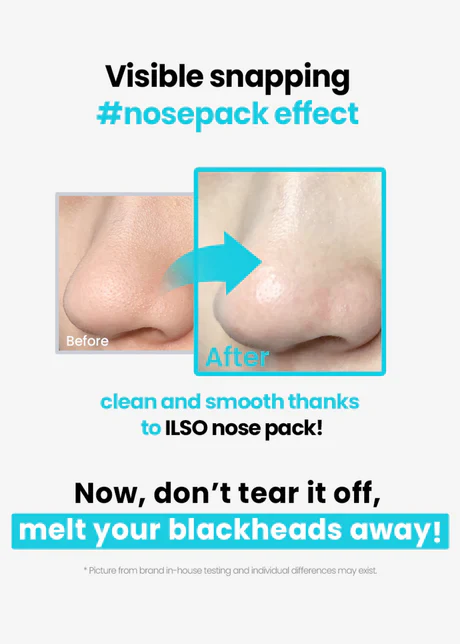 ilso Natural Mild Clear Nose Pack 5 sets - Image 7