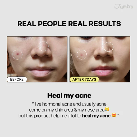 Jumiso Snail Mucin 95% + Peptide Essence 140ml - Image 3