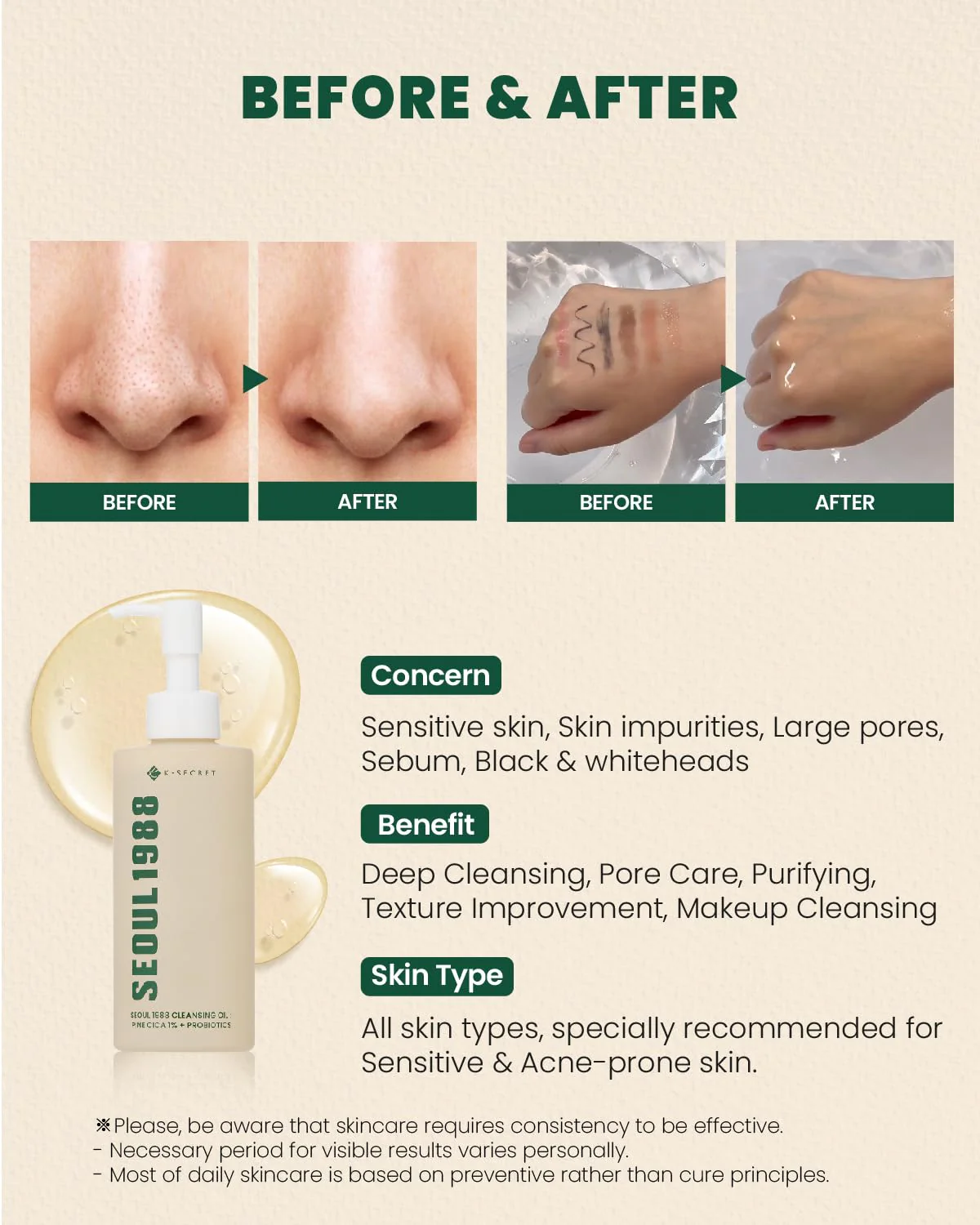 K-Secret Seoul 1988 Aceite Limpiador – Pine Cica 1% + Probióticos 150 ml - Image 7
