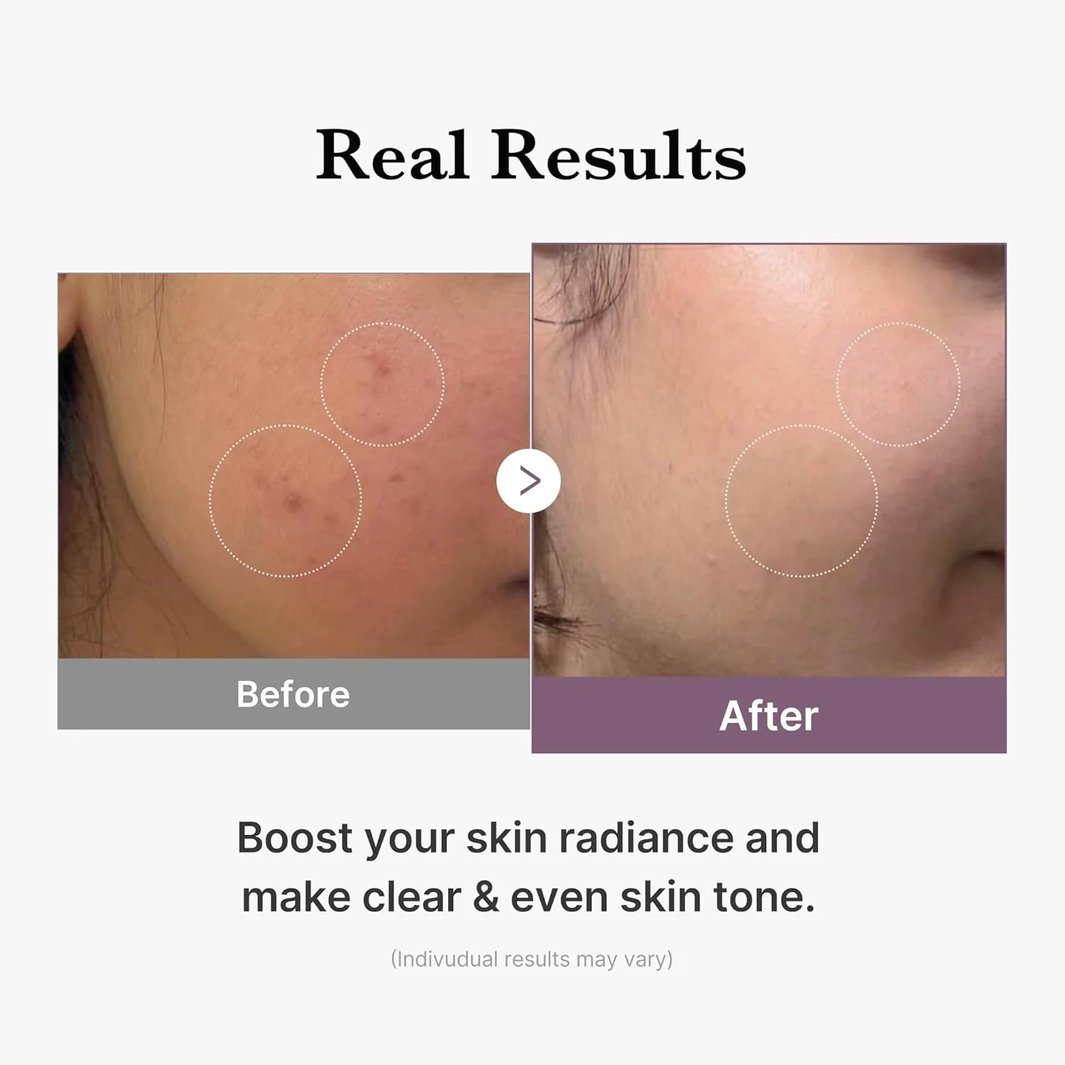 Medicube AGE-R Glutathione Glow Toner – Tónico lechoso para una piel radiante y uniforme - Image 7