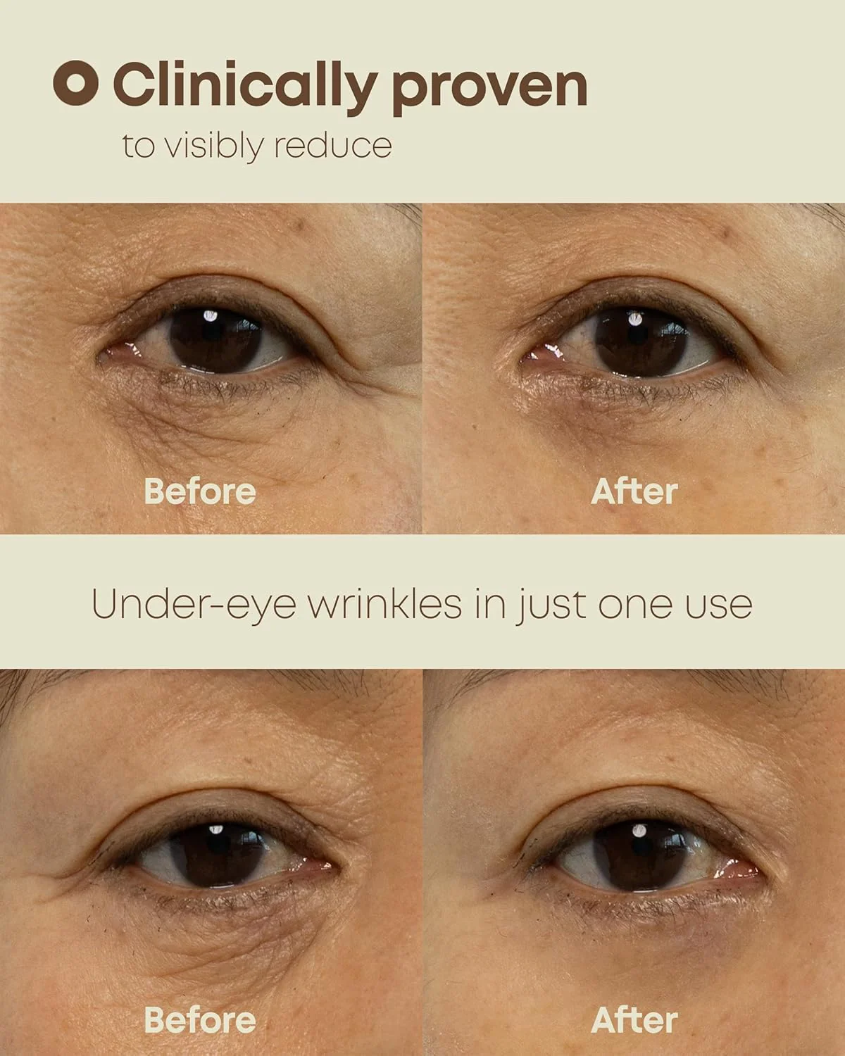 Nine Less Ever-Youth Dual Effect Eye Cream 20ml - Image 4