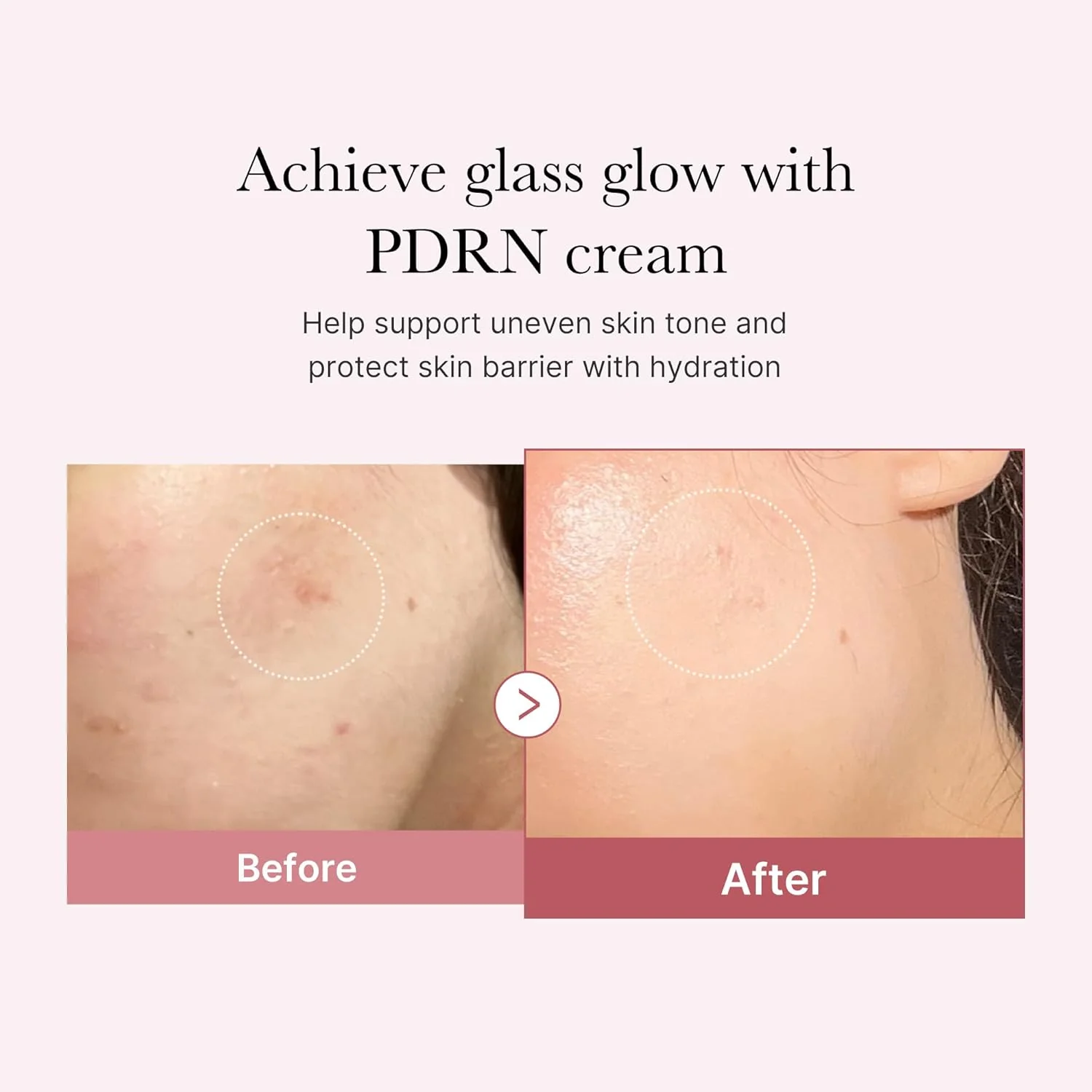 PDRN Pink Hyaluronic Moisturizing Cream Medicube 50ml - Image 6