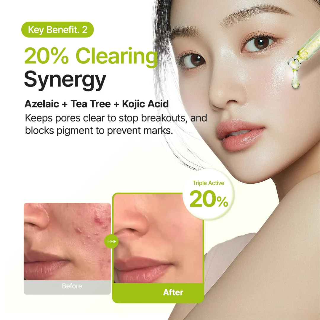 Purito Azelaic Acid 10 Kojic Tea Tree Serum 30ml - Image 7