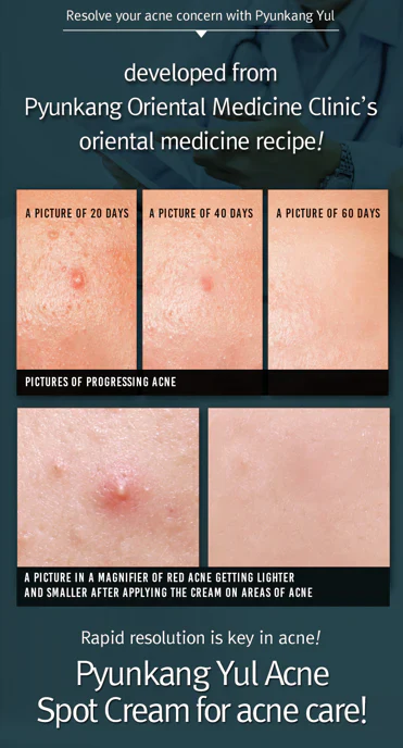Pyunkang Yul - Crema antiacné Acne Spot Cream 15 ml - Image 5