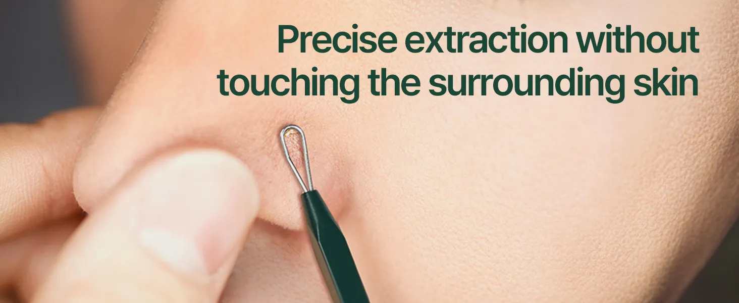 Pyunkang Yul - Pimple Extractor, estuche de estaño incluido, herramientas extractoras para eliminación de espinillas en la cara - Image 12
