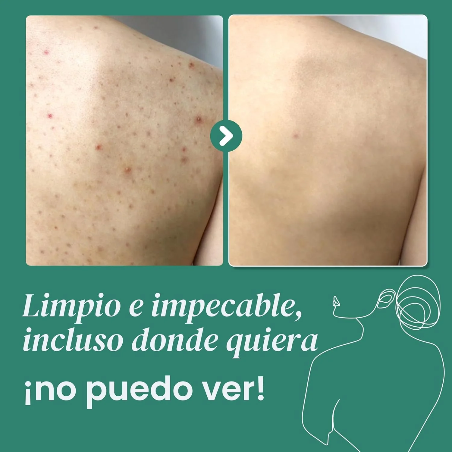Some by Me AHA.BHA.PHA 30 Days Miracle Clear Body Cleanser 400g - Image 3
