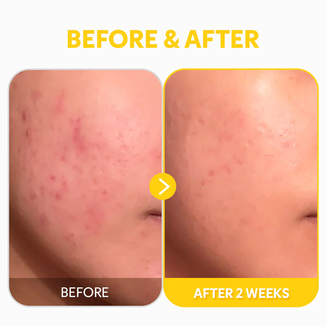 Tirtir Pure Vitamin C24 Serum – 30 ml - Image 4